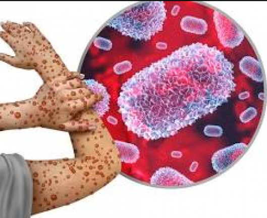 Fabry Hastalığı: Nadir Lizozomal Depo Hastalığının Tedavisinde Yeni Ufuklar Açılıyor