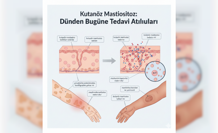 Deri Rengindeki Sırlar: Kutanöz Mastositoz Hastalığı Nedir ve Son Tedavi Atılımları Nelerdir?