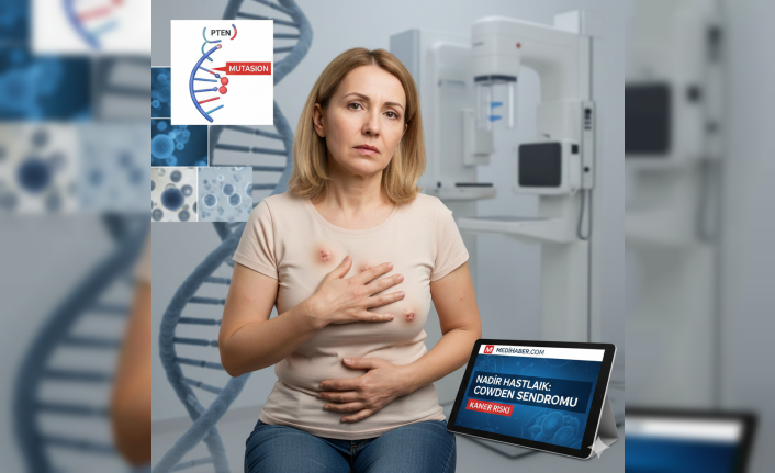Nadir Görülen Cowden Sendromu: Vücutta Oluşan Gizemli Yumrular ve Kanser Riski