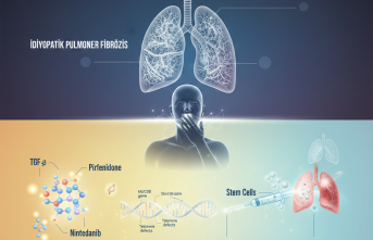 Akciğerlerin Gizemli Sertleşmesi: İdiyopatik Pulmoner Fibrözis'te Son Umut Veren Adımlar