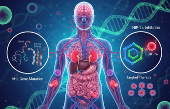 Von Hippel-Lindau Sendromu: Nadir Görülen Bir Genetik Hastalığın Tedavisinde Dönüm Noktası
