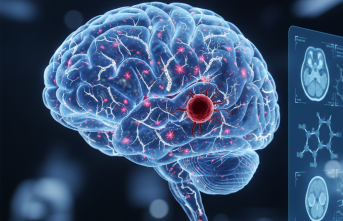 Beyindeki Gizli Tehlike: Serebral Amiloid Anjiyopati (CAA) Hakkında Bilinmesi Gerekenler ve Son Tıbbi Gelişmeler