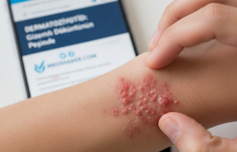 Deri döküntüsü mü yoksa dermatoziyotid mi?