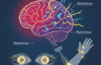 Gözlerin Kontrolden Çıktığı O An: Opsoklanus Miyoklanus