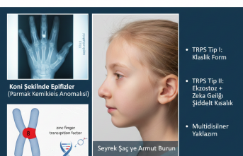 Tricorhinofalangeal Sendromu (TRPS): Kıl, Burun ve Parmakları Etkileyen Nadir Genetik Durumun Tıbbi Yolculuğu