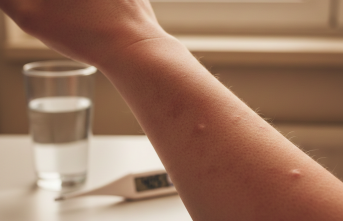 Anhidroz Belirtileri ve Vücut Isısı Üzerindeki Riskler