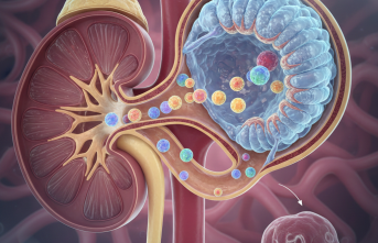 Böbreklerde Protein Kaybı Alarm Veriyor: Nefrotik Sendrom Riski