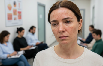 Ciltteki Koyu Lekeler Melazma Belirtisi Olabilir mi