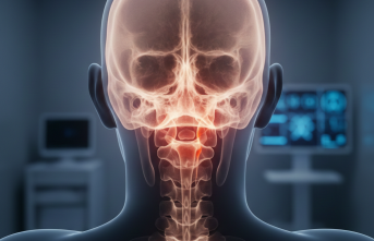 Ense Kökündeki O Sızı: Chiari Malformasyonu Nedir?