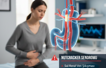 Karın Ağrısının Gizli Nedeni: Nutcracker Sendromu