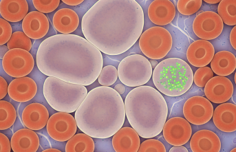 Nadir Görülen Bernard Soulier Sendromu Mercek Altında