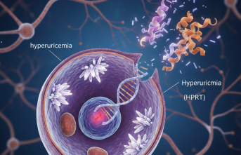 Nadir Görülen Lesch-Nyhan Sendromu Takip Altında