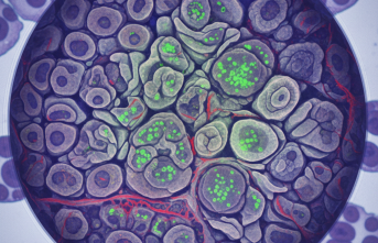 Proteus Sendromu Genetik Mutasyonlarla Gündemde