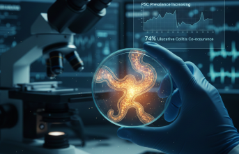 Safra Yollarında Daralma: Primer Sklerozan Kolanjit Mercek Altında