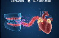 Günde en az iki kez diş fırçalamak: Yumuşak uçlu bir fırça ve florürlü macun kullanın.