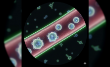 Küçük Vücutların Büyük Direnişi: Bruton Hastalığı