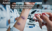 Vücudun Gizli Savunucuları Azalınca: Trombositopeni