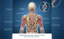 Vücudun Kendi İçindeki Sessiz Dönüşümü: Taş Adam Sendromu