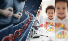 Kanın Şekli Değişince: Orak Hücreli Anemi