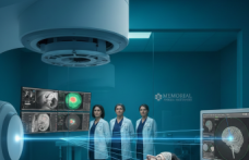 Stereotaktik Radyoterapi (Radyasyon Tedavisi)