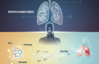  Akciğerlerin Gizemli Sertleşmesi: İdiyopatik...