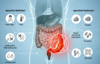 Apandisit Nedir? Belirtileri Nelerdir? 