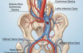  Gizemli Bir Tanı: Toliner Sendromu Nedir ve Tıbbi...