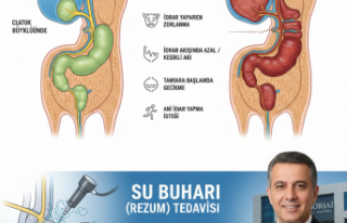PROSTAT BÜYÜMESİ, ŞİKAYETLERİ VE TEDEVİSİ
