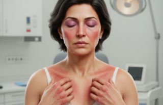 Kas ve Ciltte Gizlenen Tehdit: Dermatomiyozit'te...