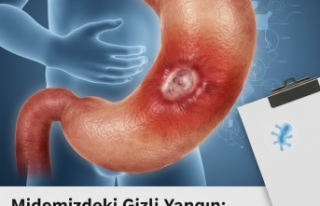 Midemizdeki Gizli Yangın: Peptik Ülserle Yaşamak