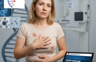 Nadir Görülen Cowden Sendromu: Vücutta Oluşan...