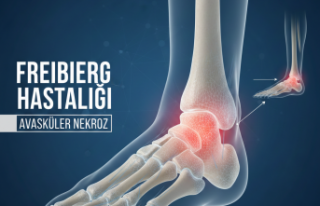 Ayak Ağrısını Hafife Almayın: Gençlerde Freiberg...