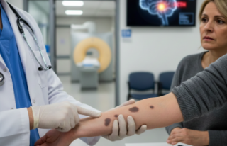 Cushing Sendromu Ameliyatı Sonrası Nelson Riski