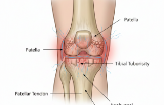 Genç Sporcularda Diz Ağrısı Riski: Osgood-Schlatter...