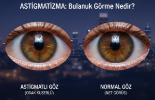 Gözlerdeki Bulanık Görüşün Sebebi Astigmatizma...