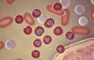 Nadir Görülen Glanzmann Trombastenisi İçin Erken...