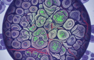 Proteus Sendromu Genetik Mutasyonlarla Gündemde