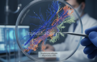 Tıbbın Nadir Dosyası: Whipple Hastalığı Mercek...