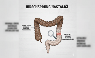 Yenidoğanlarda Bağırsak Tıkanıklığı Riski: Hirschsprung Belirtilerine Dikkat