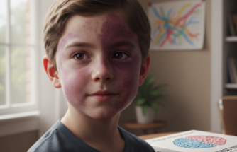 Ciltteki Kırmızı Lekelerin Ardındaki Gizem: Sturge-Weber Sendromu Nedir?