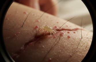 Geceleri Artan Kaşıntı Kabusu: Uyuzla Mücadele