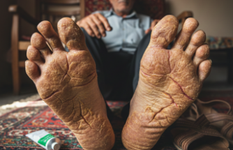 Adriyatik’ten Anadolu’ya Uzanan Nadir Miras Mal de Meleda