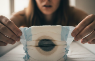 Alkaptonüri Hastalığında Erken Tanı ve Yaşam Kalitesi