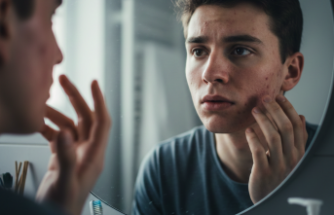 Aynadaki Davetsiz Misafir: Akne Vulgaris ile Yaşamak