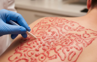 Cilt Üzerinde Kabaran Çizgiler: Dermotografi Hakkında Bilinmesi Gerekenler