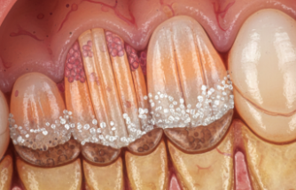 Diş Minesinin Oluşum Yolculuğu: Amelogenezis Süreci