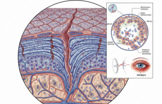 Nadir Görülen Arlekin Tipi İktiyozis Hastalığında Erken Tanı Hayat Kurtarıyor