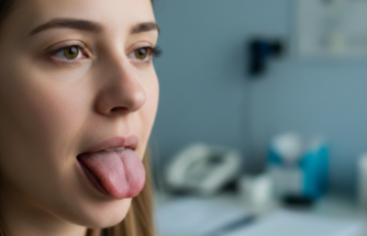 Nadir Görülen Melkersson Rosenthal Sendromu Mercek Altında