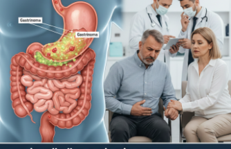 Nadir Görülen Sindirim Sorunu: Zollinger Ellison Sendromu Belirtileri