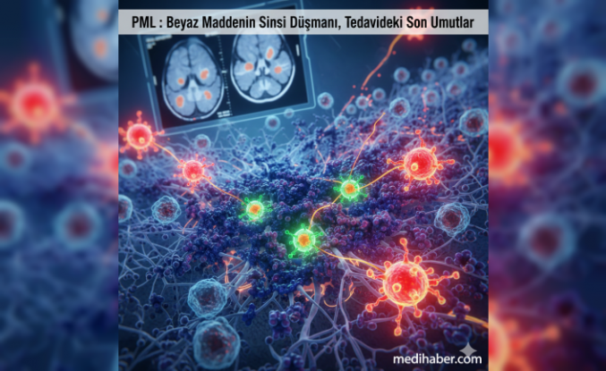 PML: Beyaz Maddenin Sinsi Düşmanı, Tedavideki Son Umutlar